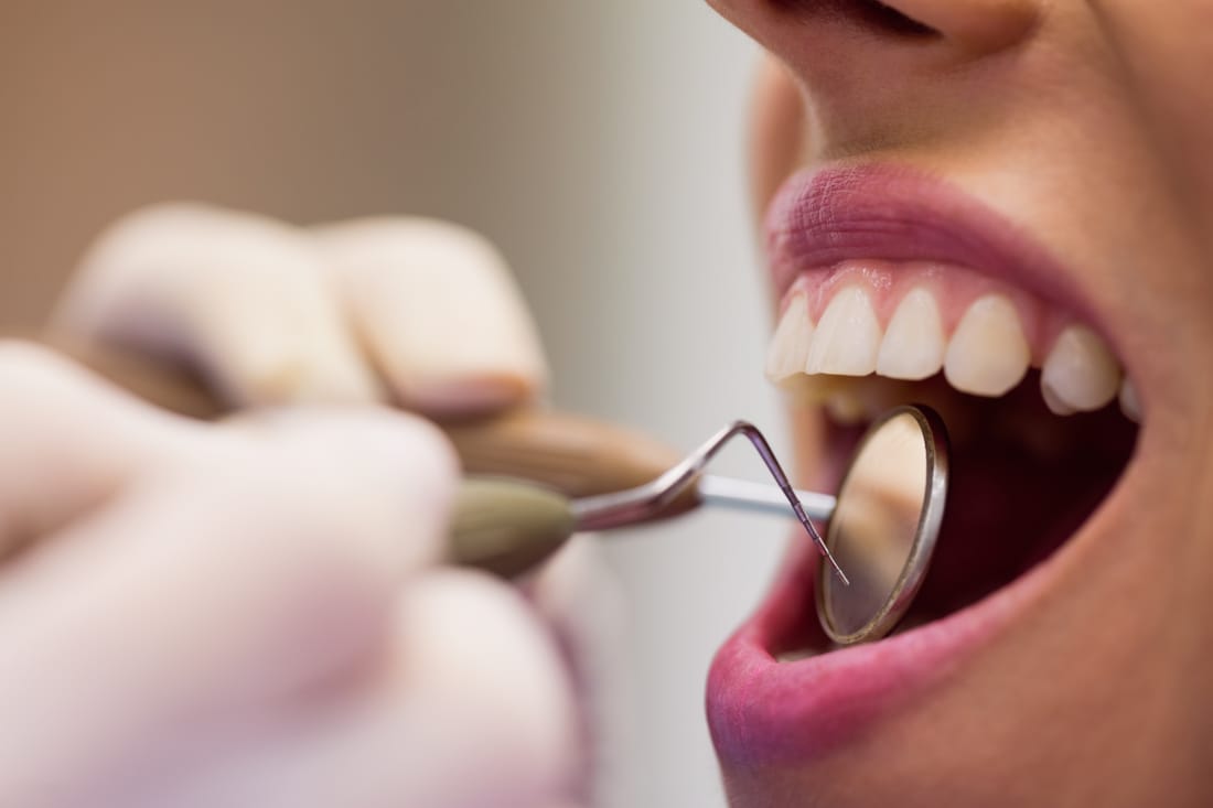 Instrumental odontológico de odontología general sobre superficie de trabajo — Consciencia Odontológica