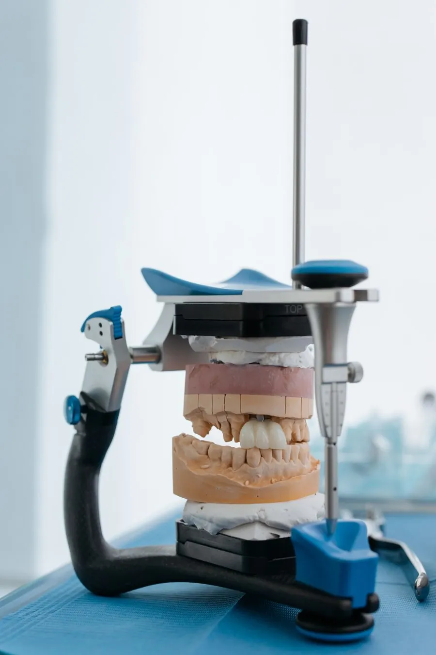 Articulador dental con modelos de yeso de dentadura superior e inferior — laboratorio de prótesis dental Consciencia Odontológica Mendoza