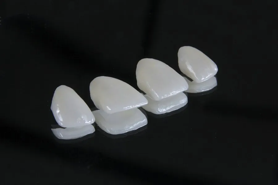 Detalle editorial de cuatro carillas dentales de porcelana sobre fondo oscuro — restauración estética de alta precisión