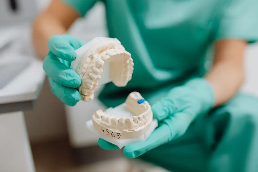 Manos enguantadas sosteniendo un modelo de yeso de dentadura superior — laboratorio de prótesis dental Consciencia Odontológica